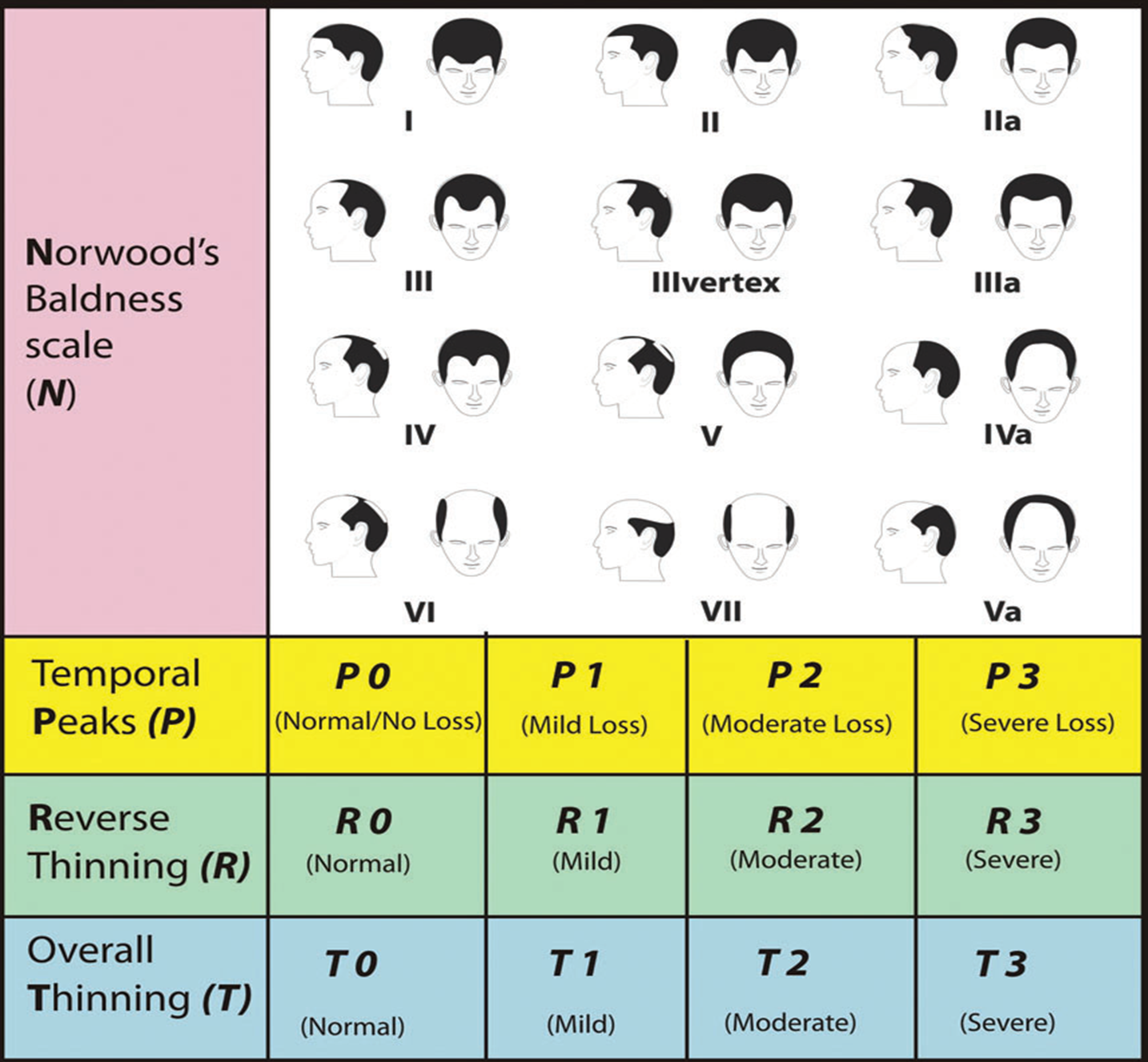 Сколько в среднем волос у мужчины. Шкала Норвуда облысение. Толщина волоса мужчина и женщина. Типы Норвуда. Шкала Гамильтона-Норвуда – степени облысения.